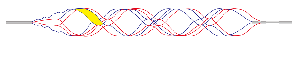 Clot Stent Retriever Clot Stent Retriever